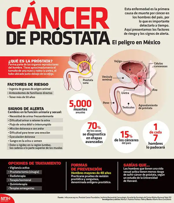 Estos son los principales datos del Cáncer de Próstata en México