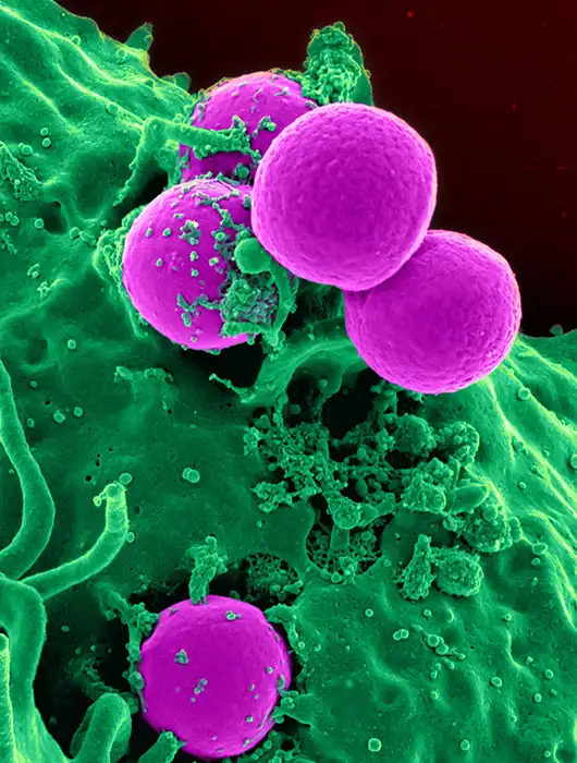 Bacteria de SARM / Foto: Wikipedia