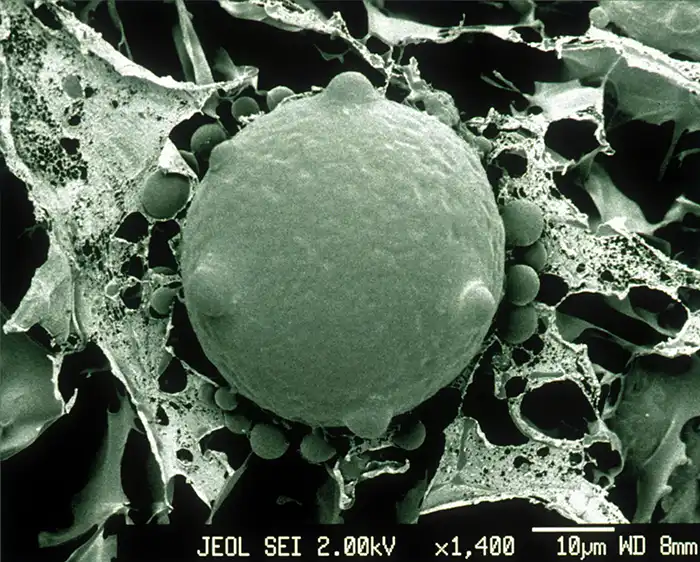 Micrografía electrónica una zoospora y esporangios del hongo Batrachochytrium dendrobatidis. 