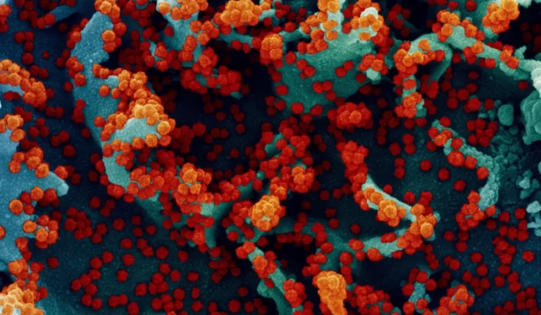La infección del SARS-CoV-2 a las células podría haberse diseñado en laboratorio.
